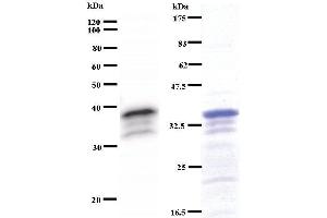 Left: ZNF161 staining. (VEZF1 anticorps)