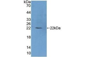 Detection of Recombinant PLCb1, Human using Polyclonal Antibody to Phospholipase C Beta 1 (PLCB1) (Phospholipase C beta 1 anticorps  (AA 316-476))