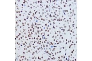 Immunohistochemistry of paraffin-embedded rat ovary using Acetyl-Histone H2B-K12 antibody (ABIN7267731) at dilution of 1:200 (40x lens).