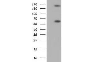 Western Blotting (WB) image for anti-Butyrophilin, Subfamily 1, Member A1 (BTN1A1) antibody (ABIN1496988) (BTN1A1 anticorps)