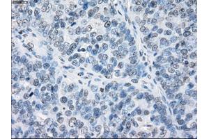 Immunohistochemical staining of paraffin-embedded Kidney tissue using anti-FCGR2A mouse monoclonal antibody. (FCGR2A anticorps)