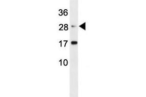 Erythropoietin antibody western blot analysis in mouse L929 lysate (EPO anticorps  (AA 20-48))