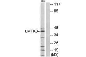 Western blot analysis of extracts from 293 cells, using LMTK3 Antibody.