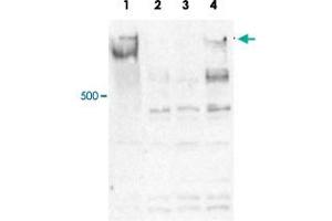 Western blot was performed on whole cell lysates from mouse embryonic stem cells (E14Tg2a) with Mll4 polyclonal antibody , diluted 1 : 500 in PBS-Tween containing 5% skimmed milk. (MLL4 anticorps)
