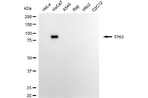 Western blotting analysis using TP63 antibody (ABIN7800693).