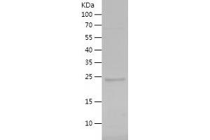 Minichromosome Maintenance Complex Component 3 Associated Protein (MCM3AP) (AA 1771-1980) protein (His tag)