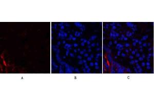 Immunofluorescence analysis of rat lung tissue. (PI3K p85 alpha/gamma anticorps)