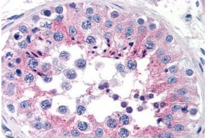 Human Testis (formalin-fixed, paraffin-embedded) stained with CLU antibody ABIN239817 at 10 ug/ml followed by biotinylated anti-mouse IgG secondary antibody ABIN481714, alkaline phosphatase-streptavidin and chromogen. (Clusterin anticorps)