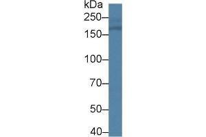 Detection of CD11b in Rat Serum using Polyclonal Antibody to Integrin Alpha M (CD11b)