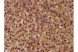 IHC image of ABIN7169088 diluted at 1:300 and staining in paraffin-embedded human adrenal gland tissue performed on a Leica BondTM system. (NEK1 anticorps  (AA 626-809))