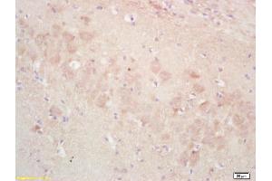 Formalin-fixed and paraffin embedded rat brain labeled with Rabbit Anti-ADORA2B Polyclonal Antibody, Unconjugated (ABIN1713360) at 1:200 followed by conjugation to the secondary antibody and DAB staining