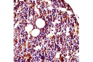 Lyn antibody immunohistochemistry analysis in formalin fixed and paraffin embedded mouse bone (femur).