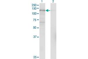 Western Blot analysis of USP15 expression in transfected 293T cell line by USP15 monoclonal antibody (M01), clone 1C10. (USP15 anticorps  (AA 1-235))
