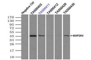 Image no. 8 for anti-Mitogen-Activated Protein Kinase Kinase 4 (MAP2K4) antibody (ABIN1499480)