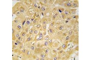 anti-Integrin-Linked Kinase (ILK) (AA 11-41) antibody