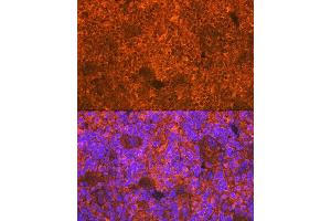 Immunofluorescence analysis of rat spleen using CD3D Rabbit mAb (ABIN7266193) at dilution of 1:100 (40x lens). (CD3D anticorps)