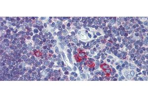 Immunohistochemistry with Human Thymus lysate tissue at an antibody concentration of 5.