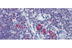Immunohistochemistry with Human Thymus lysate tissue at an antibody concentration of 5. (Transferrin Receptor 2 anticorps  (Middle Region))