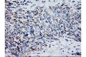 Immunohistochemistry (IHC) image for anti-X-Prolyl Aminopeptidase (Aminopeptidase P) 3, Putative (XPNPEP3) antibody (ABIN1501766)