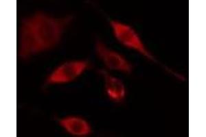 ABIN6275309 staining COLO205 cells by IF/ICC. (PNPLA6 anticorps  (Internal Region))