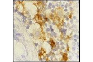 Immunohistochemistry (IHC) image for anti-CD209 (CD209) (Extracellular Domain) antibody (ABIN492511) (DC-SIGN/CD209 anticorps  (Extracellular Domain))