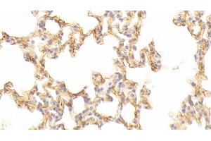 Detection of ICAM1 in Mouse Lung Tissue using Polyclonal Antibody to Intercellular Adhesion Molecule 1 (ICAM1)