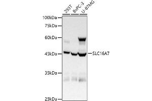 Western blot analysis of extracts of various cell lines, using (ABIN6134859, ABIN6147861, ABIN6147862 and ABIN6215999) at 1:1000 dilution. (SLC16A7 anticorps  (C-Term))