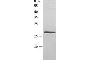 Western Blotting (WB) image for UL16 Binding Protein 1 (ULBP1) (AA 26-216) protein (His-IF2DI Tag) (ABIN7125651)