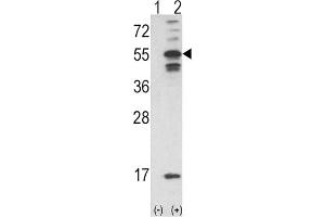 Western Blotting (WB) image for anti-Calcium/calmodulin-Dependent Protein Kinase II alpha (CAMK2A) antibody (ABIN3003199) (CAMK2A anticorps)