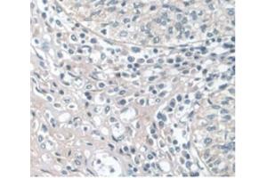 Detection of APOA1 in Human Prostate Gland Tissue using Monoclonal Antibody to Apolipoprotein A1 (APOA1) (APOA1 anticorps  (AA 122-267))