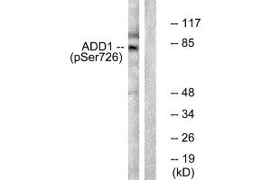 Western Blotting (WB) image for anti-Adducin 1 (Alpha) (ADD1) (pSer726) antibody (ABIN1847202)