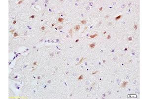 Formalin-fixed and paraffin embedded rat brain labeled with Anti-5-HT Polyclonal Antibody, Unconjugated  at 1:200 followed by conjugation to the secondary antibody and DAB staining. (Serotonin anticorps)