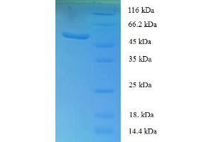 Sclerostin Domain Containing 1 (SOSTDC1) (AA 24-206) protein (GST tag)