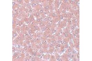 Immunohistochemistry (IHC) image for anti-Nsa1p (NSA1) (C-Term) antibody (ABIN1030550) (Nsa1p (NSA1) (C-Term) anticorps)