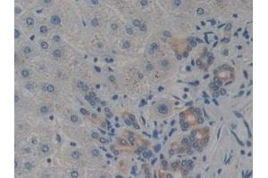 Detection of CARD9 in Human Liver Tissue using Polyclonal Antibody to Caspase Recruitment Domain Family, Member 9 (CARD9)