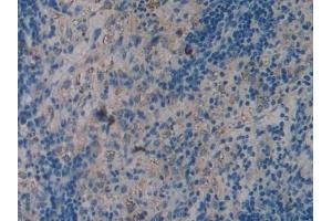 Detection of TLR4 in Rat Spleen Tissue using Polyclonal Antibody to Toll Like Receptor 4 (TLR4)