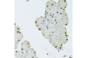 Immunohistochemistry of paraffin-embedded Mouse pancreas using FIP1L1 antibody (ABIN6131645, ABIN6140640, ABIN6140641 and ABIN6222954) at dilution of 1:100 (40x lens).