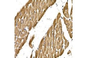 Immunohistochemistry of paraffin-embedded rat heart using PDGFB Rabbit pAb (ABIN3021688, ABIN3021689, ABIN3021690 and ABIN6215511) at dilution of 1:150 (40x lens).
