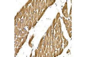 Immunohistochemistry of paraffin-embedded rat heart using PDGFB Rabbit pAb (ABIN3021688, ABIN3021689, ABIN3021690 and ABIN6215511) at dilution of 1:150 (40x lens). (PDGFB anticorps  (AA 20-241))