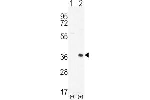 Western Blotting (WB) image for anti-Proto-Oncogene Pim-2 (Serine Threonine Kinase) (PIM2) antibody (ABIN3003584)