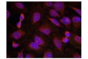 Image no. 1 for anti-B-Cell CLL/lymphoma 2 (BCL2) (Ser70) antibody (ABIN197204) (Bcl-2 anticorps  (Ser70))