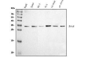 Western blot analysis of RPL8 using anti-RPL8 antibody (ABIN7601179).