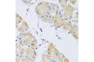 Immunohistochemistry of paraffin-embedded human stomach using CLIP1 antibody. (CLIP1 anticorps  (AA 1228-1427))
