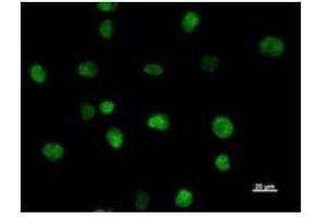 Immunostaining analysis in HeLa cells. (SATB2 anticorps)