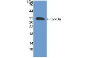 Western blot analysis of recombinant Mouse LTb. (LTB anticorps  (AA 58-304))