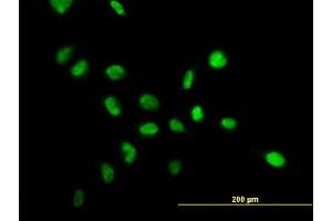 Immunofluorescence of monoclonal antibody to NPM1 on HeLa cell. (NPM1 anticorps  (AA 1-294))