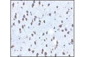 Immunohistochemistry of SCF in mouse brain tissue with this product at 2. (KIT Ligand anticorps  (Center))