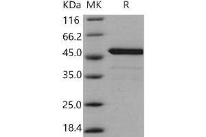 Western Blotting (WB) image for BH3 Interacting Domain Death Agonist (BID) (Active) protein (GST tag,His tag) (ABIN7320305)