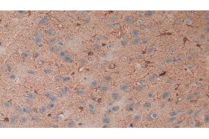 Detection of S100B in Rat Cerebrum Tissue using Polyclonal Antibody to S100 Calcium Binding Protein B (S100B) (S100B anticorps  (AA 1-92))