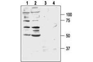 Western blot analysis of DU 145 (lanes 1 and 3) and PC-3 (lanes 2 and 4) human prostate carcinoma cell lines: - 1,2. (GRPR anticorps  (3rd Extracellular Loop))